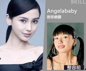 北京整容爆料案件最新,揭开医美行业潜规则与维权困境